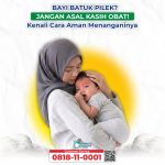 Edukasi: Atasi Batuk Pilek Bayi Tanpa Langsung Obat Kimia